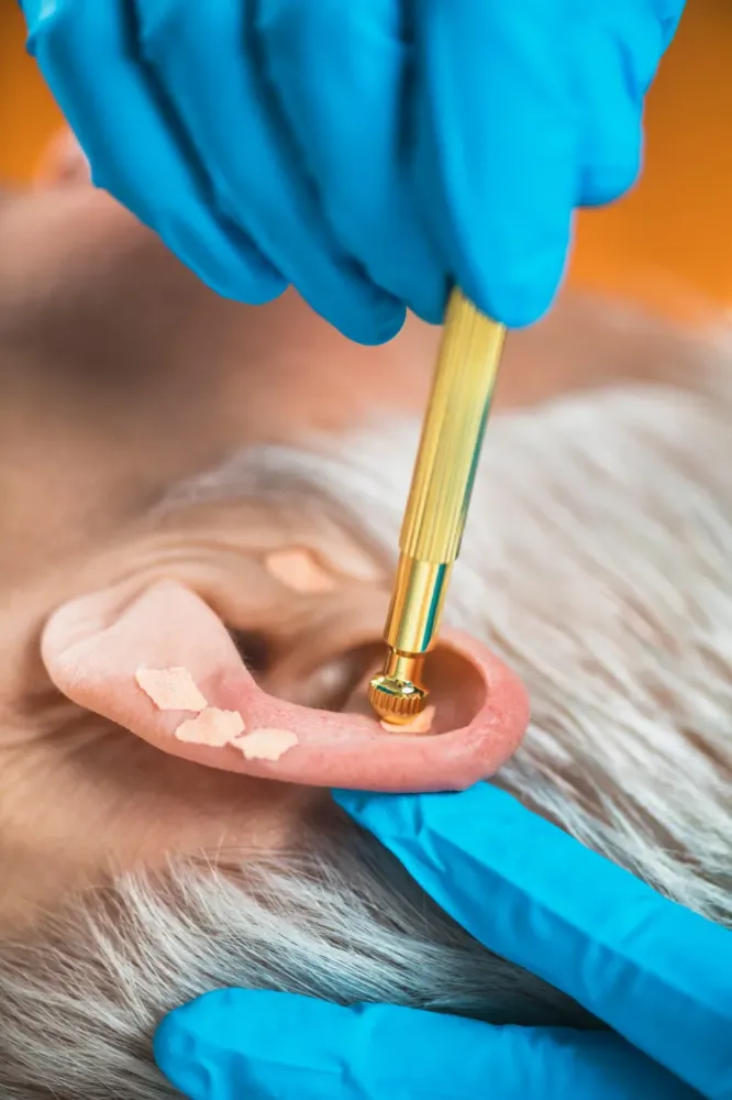 Laser froid à Saint-Estèphe